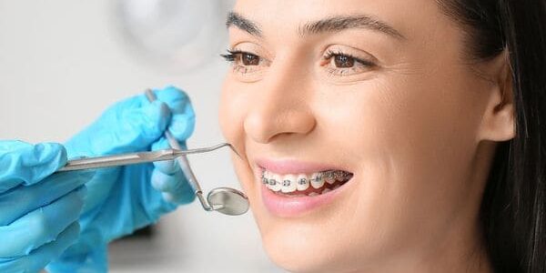 عيادة تقويم أسنان بالمهندسين